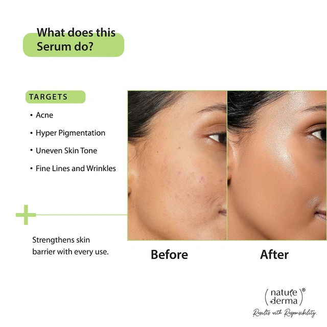 NATURE DERMA 2% Salicylic Acid Serum – 30 ml - Image 3